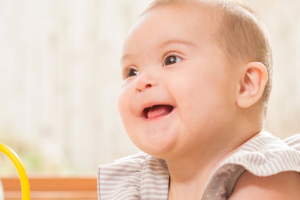 Bebês com Síndrome de Down: desenvolvimento e cuidados
